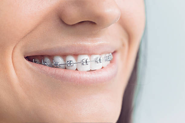 Best Preventive Dentistry  in Maurice, LA